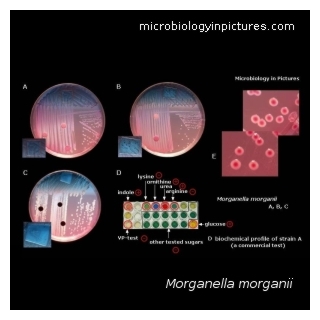 morganella